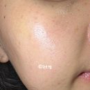 믿음약품 | 일양약품 기미크림 멜라포미 토닝크림 솔직후기 색소침착,기미,잡티 케어 미백크림 추천