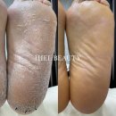 히엘뷰티 이미지