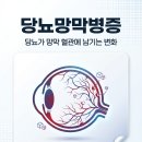 죽전안과의원 이미지