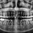 서울바른송치과의원 이미지