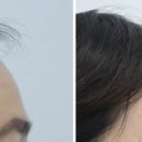 리프성형외과의원 이미지