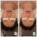 메디스케어 | 용인피부관리 경락맛집 메디스파연솔직후기