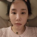 [건대두피관리/서울광진 웰슨 두피탈모 케어센터] 광진구 최초 탈모케어 클리닉 후기🧴💆‍♀️