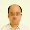 맞춤가발 vs 기성가발, 인천 영종도 남자 맞춤가발 비교 Q&amp;A까지