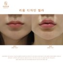 리움의원 네이버블로그