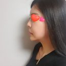 제이앤성형외과의원 | 강남역 제이앤 성형외과 코재수술 상담후기 / 굴보쌈은 맛있다!