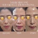 네오필 | 네오필? 후기들만 모아봤어요!!
