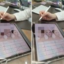 온다리프팅 5만줄 후기 얼굴이 채워지다.