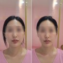끌리메 장유점 | w.(김해/장유) 웨딩 관리는 작은얼굴관리 끌리메 장유점 추천후기