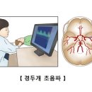 뇌졸중을 제대로 이해하고 살기 이미지