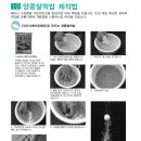 콩알 이미지