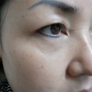 눈가주름 스트레스였는데...답은 안티에이징크림 처발~~이 답이었어요. (눈가주름없애는법, 눈밑주름없애는시술, ahc아이크림 등등) 이미지