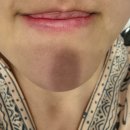 마루에스테틱 | 세종 피부관리 나성동 건조 모공 관리하는 아르드뽀 에스테틱 실후기