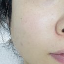 제이 메디컬 | [뷰티] 대구에스테틱 동구피부관리 - 제이에르 대구점 후기(feat. 스킨디톡스)