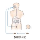 세균성 이질[shigellosis] 이미지