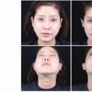 서울나온피부과의원 이미지