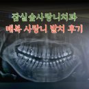 송파다인치과의원 | 잠실숲사랑니 치과| 매복사랑니 2개 동시에 뺀 솔직후기