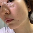 [웰라쥬] 끈적임 없는 수분앰플 / 리얼 히알루로닉 블루 100 앰플 솔직후기