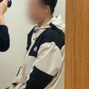 차한의원 | 천안 새살침 여드름 흉터치료 2회차 여드름 흉터 한의원 내돈내산 후기