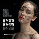 울산비비성형외과의원 이미지