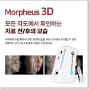 보라매치과 인비절라인후기가 많은 치과를 고려하신다면
