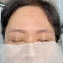 흥케이병원(흥K병원) | 시흥눈썹문신 잔흔·흉터까지 커버 가능할까? 직접 받아본 리얼 후기