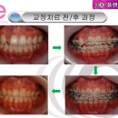 e-플랜트치과 이미지