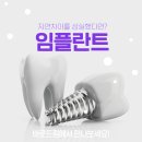 조이치과기공소 | 안산치과 후기 임플란트 잘하는곳 검토 비교