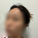 명지헤어라인 | 명지왁싱 "레비에" 여자 헤어라인 왁싱 후기 눈썹 뒷목 브라질리언 추천