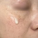 헤어져 | 대웅제약 이지듀 vs 동국제약 마데카앰플 내돈내산 후기 (기미주근깨 이젠 헤어져볼까)
