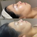 센텀1로9 | 해운대에스테틱 겨울철피부관리 추천 헤스티움에서 리베룩관리 받은 후기