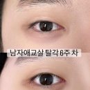 누늘브로우