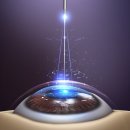 아름다운눈안과의원 이미지