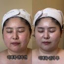 지에스25 삼호대불점 | 영암 삼호 퓨어미에스테틱 기미 주근깨 해결