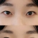 더모먼트 이미지