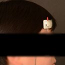 일곱난장이치과의원 | 어린이 치아교정 시작 시기, 무턱 주걱턱 반대교합이라면? 5살아이 아빠 교정전문의가 '만 7세'를 강조...