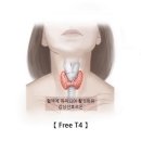 유리 싸이록신 Free thyroxineFree T4 이미지