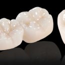 한치과기공소 이미지