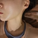 수원-0622 | 수원피부관리 영통 올리다에스테틱 수원본점 겨울철 관리 후기