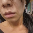 봄눈피우다의원