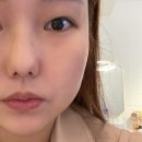 엑소리젠토탈뷰티