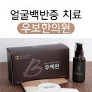 얼굴백반증치료 한의원 한번 믿어봐