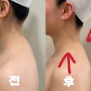 건대피부관리 피부합 2회차방문 윤곽 거북목관리 솔직후기