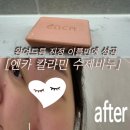 엔카 | 왕여드름 진정 성공&gt;&lt; 엔카 칼라민 여드름비누 후기