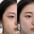 복주는뷰티샵 | 김천눈썹문신추천 1:1 맞춤으로 해주는 후기 많은 로건뷰티샵