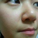 [여드름화장품] 순한 한방화장품 &#39;타임인네이처&#39; 후기