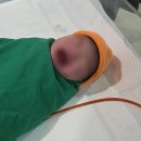 [출산 기록] 한별여성의원 제왕절개 후기(긴 글 주의)_수술 첫 날, 입원