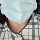 해운대나눔과행복병원 | [해운대] 갑상선 고주파시술, 나눔과행복병원 후기