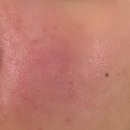 아울렛약국 이미지