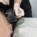 창원피부 슈퍼맥스 하이푸리프팅 물방울관리 남양동 난너를예쁘게해